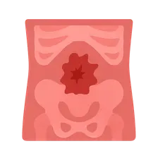 Abdominal Trauma Imaging
