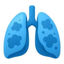 Upper Respiratory Tract Infections