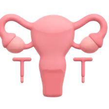Permanent Contraception Methods