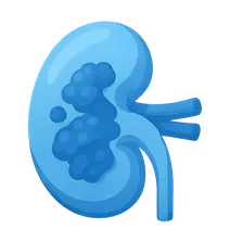 Kidney diseases