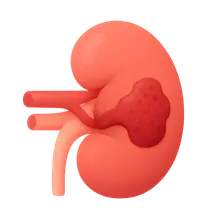 Vascular Diseases of the Kidney