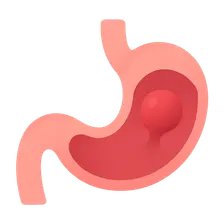 Polyps and Neoplasms