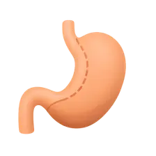Metabolic Effects of Bariatric Surgery