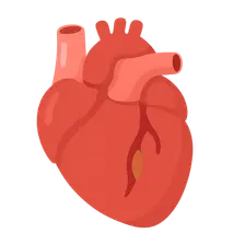 Acute Coronary Syndromes