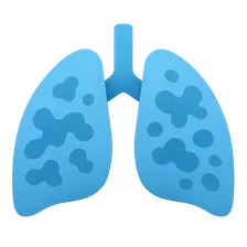 Acute Respiratory Distress Syndrome