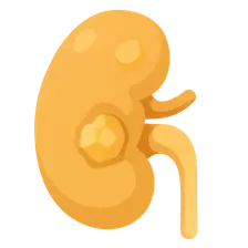Kidney Stones and Obstructive Uropathy