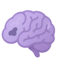 Alzheimer's disease