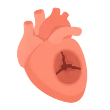 Valvular heart disease