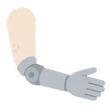 Upper Limb Prosthetics