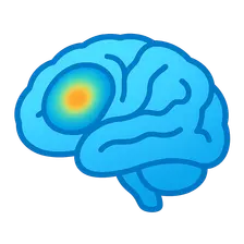 Neurological Nuclear Medicine