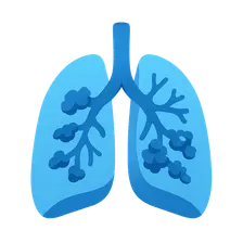 Cystic Fibrosis