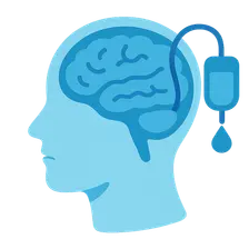 Intracranial pressure management