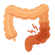 Irritable bowel syndrome