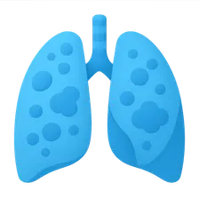 Sarcoidosis