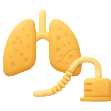 Ventilator-associated pneumonia