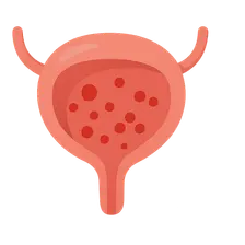 Hematuria Evaluation