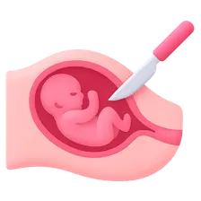 Cesarean Section: Indications and Techniques