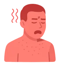 Neuroleptic malignant syndrome