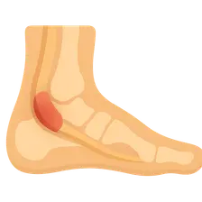 Tendon Disorders of Foot and Ankle