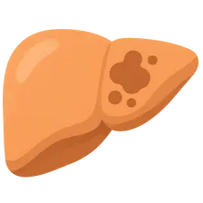 Autoimmune hepatitis