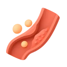 Dyslipidemias and Atherosclerosis