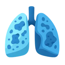 Interstitial Lung Diseases