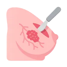 Management of Ductal Carcinoma In Situ
