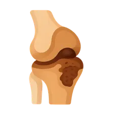 Bone and joint pathology