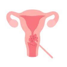 Gynecologic Cytology