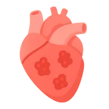 Infective endocarditis