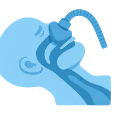 Perioperative Management of Sleep Apnea