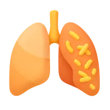 Multi-drug Resistant Tuberculosis
