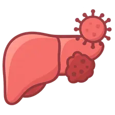 Hepatitis C and hepatocellular carcinoma