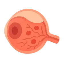 Inflammatory Retinal Diseases