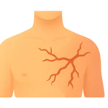Lightning Injuries