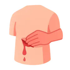 Circulation assessment and hemorrhage control