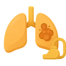 Ventilator-Associated Pneumonia