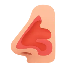 Rhinitis