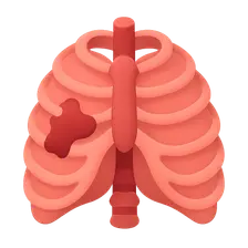 Chest Trauma Imaging