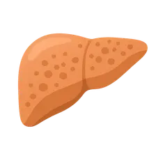 Liver pathology (hepatitis, cirrhosis)