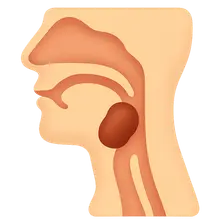 Dysphagia