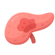 Severity assessment in acute pancreatitis