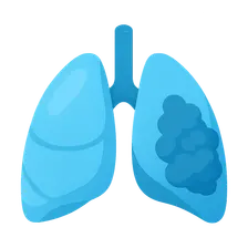 Chronic Respiratory Diseases