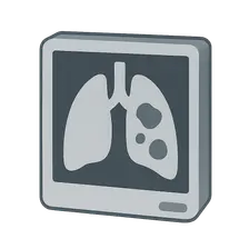 Common radiologic findings in pathology
