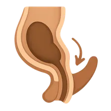 Defecation reflex