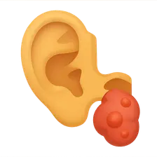 Complications of Otitis Media