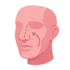 Breast Reconstruction