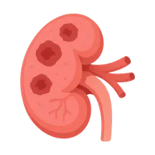 Renal vascular diseases