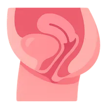 Cystocele and Urethrocele