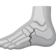 Foot Fractures